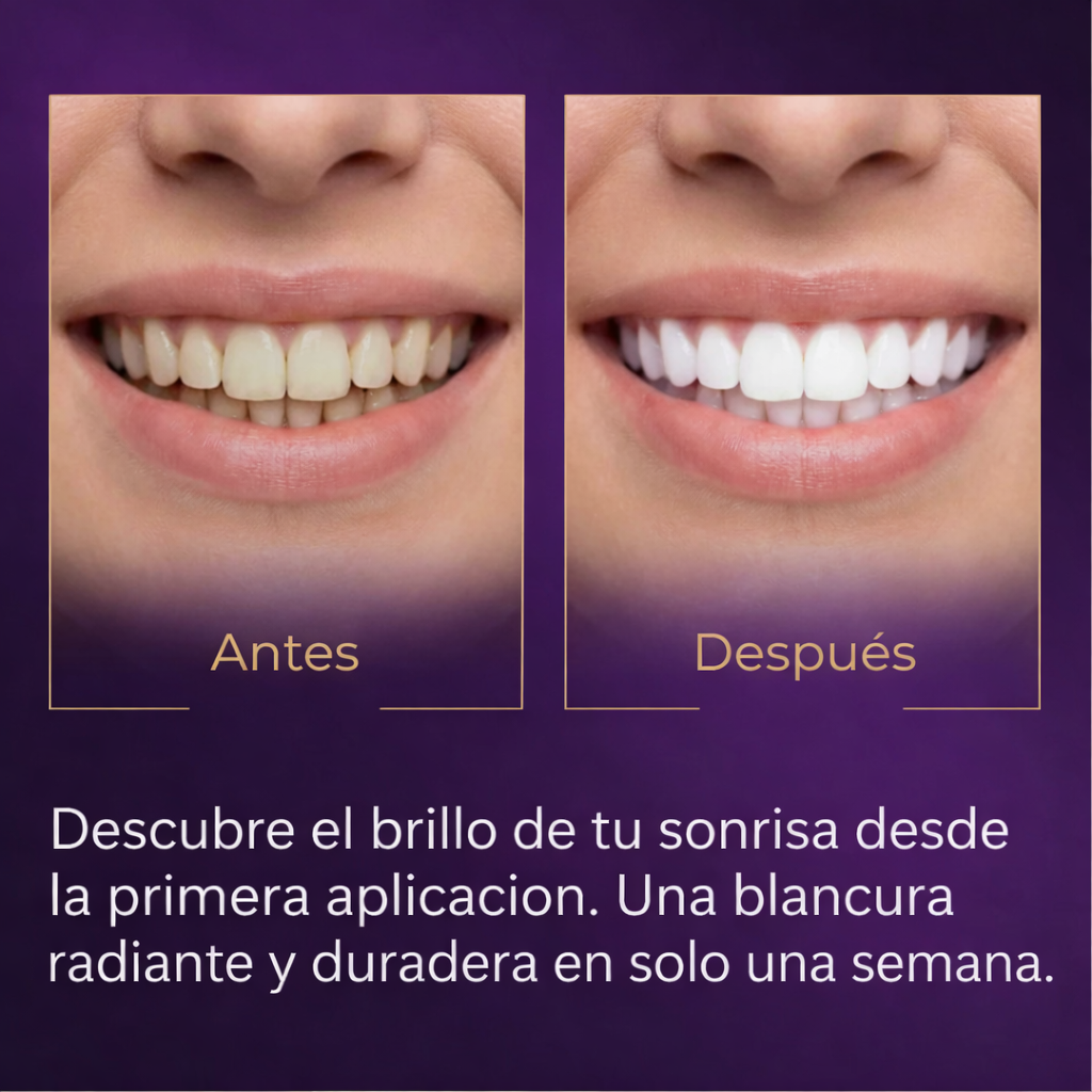 whitening strips