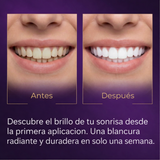 whitening strips